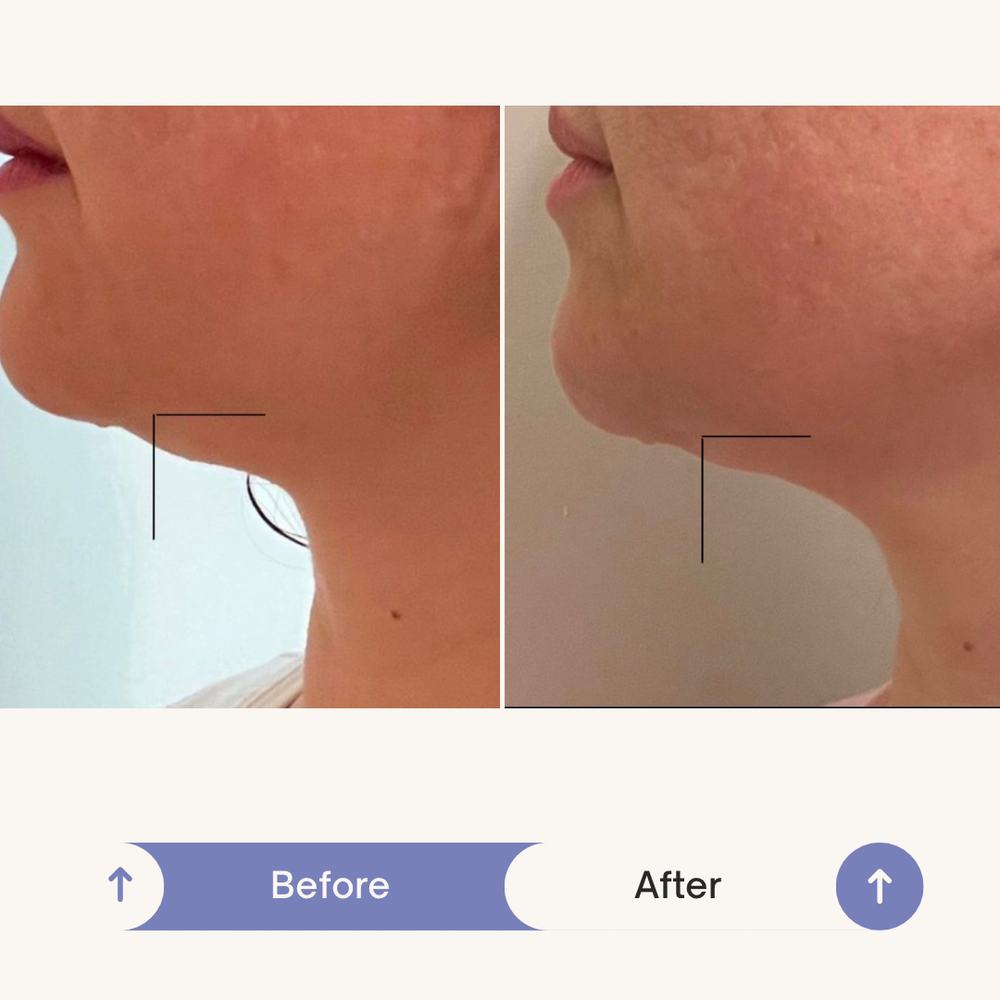 2 months Before and After SculptMe Body Contouring Cream - Aryella Cosmetics™ #